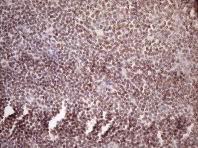 WTAP Antibody in Immunohistochemistry (Paraffin) (IHC (P))