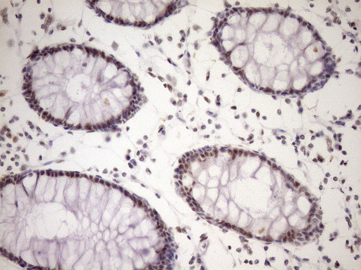 WTAP Antibody in Immunohistochemistry (Paraffin) (IHC (P))