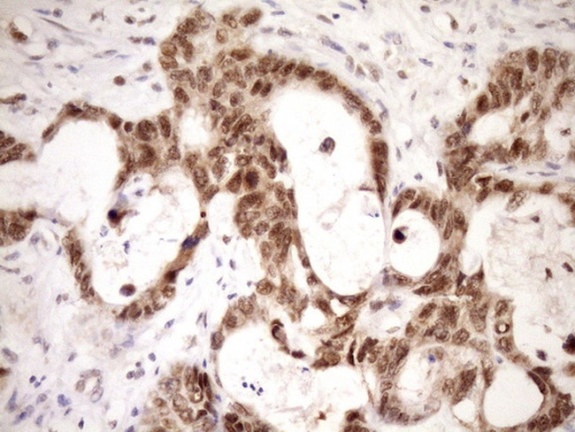 WTAP Antibody in Immunohistochemistry (Paraffin) (IHC (P))