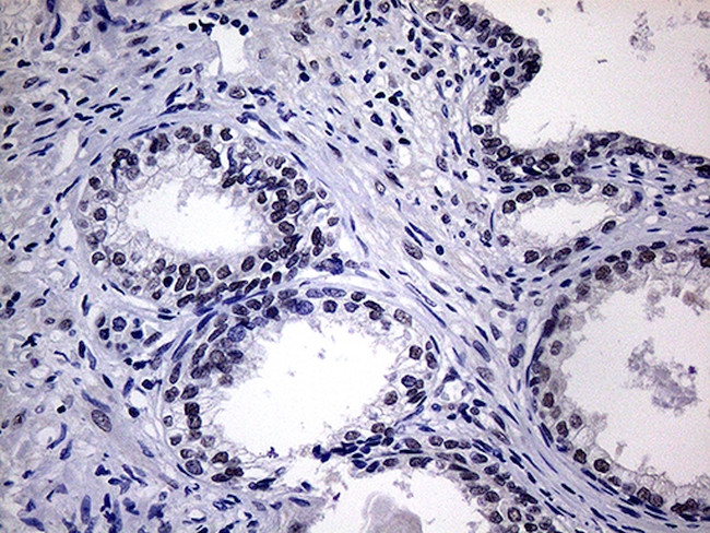 WTAP Antibody in Immunohistochemistry (Paraffin) (IHC (P))