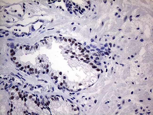 WTAP Antibody in Immunohistochemistry (Paraffin) (IHC (P))