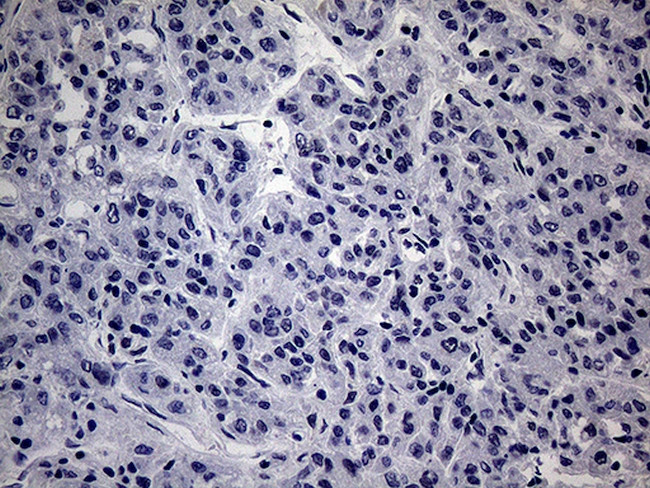 WTAP Antibody in Immunohistochemistry (Paraffin) (IHC (P))