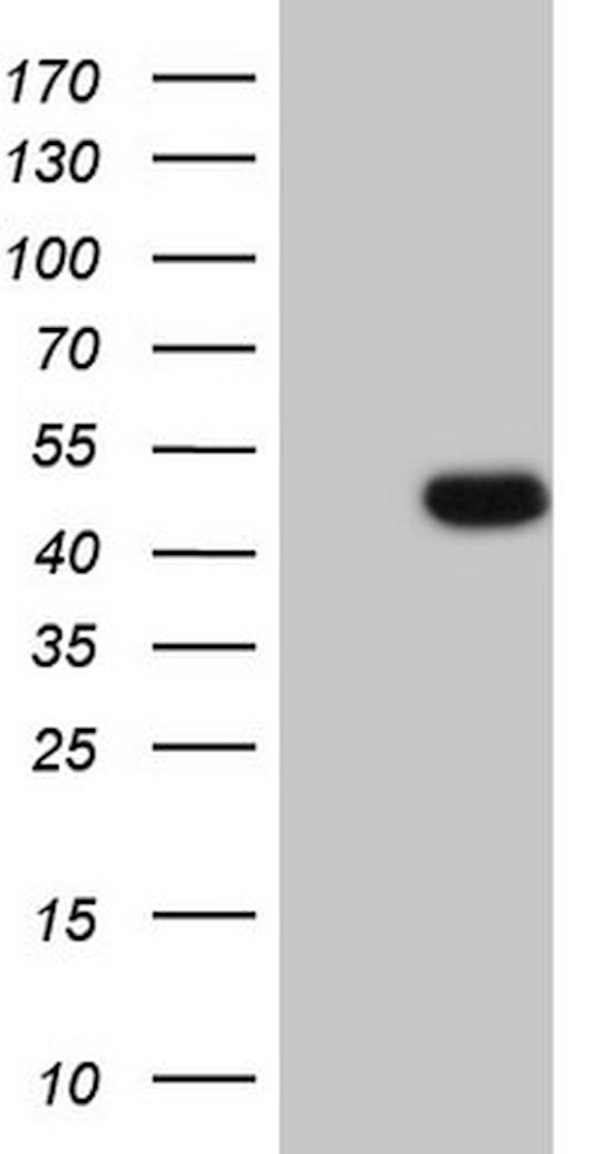 WTAP Antibody in Western Blot (WB)