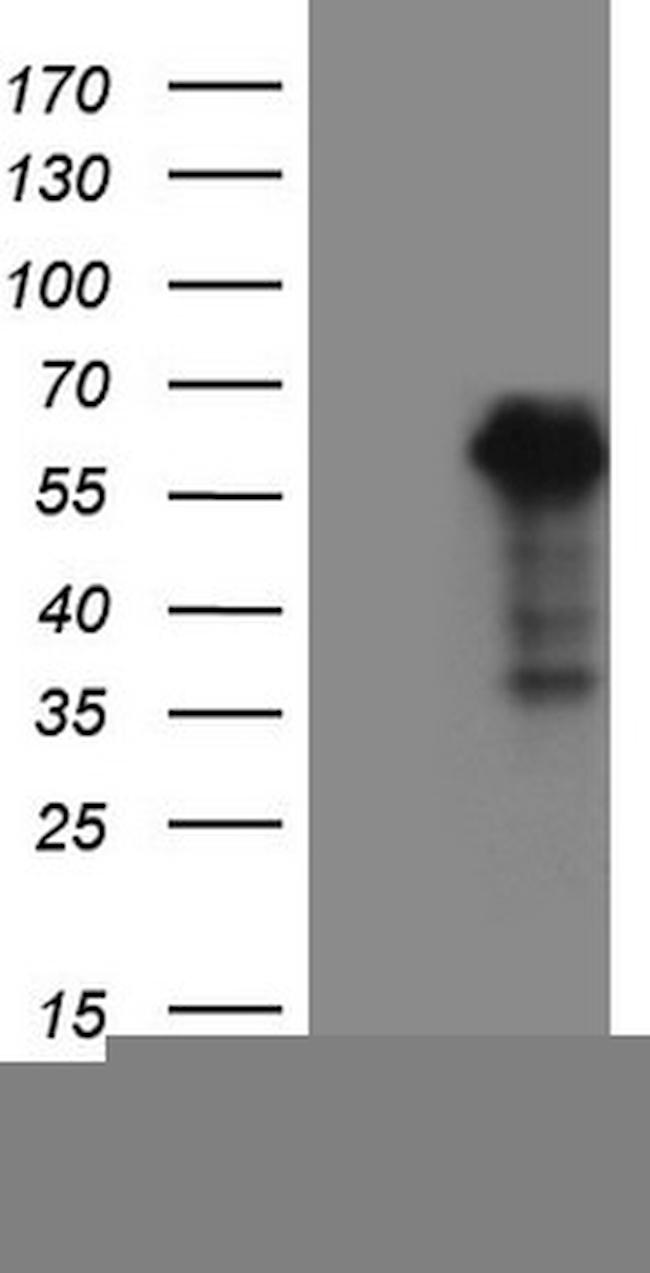 WTAP Antibody in Western Blot (WB)