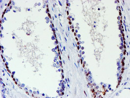 WWTR1 Antibody in Immunohistochemistry (Paraffin) (IHC (P))