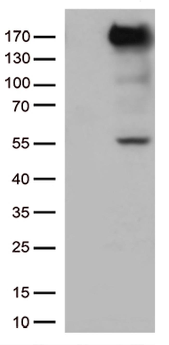 XDH Antibody in Western Blot (WB)