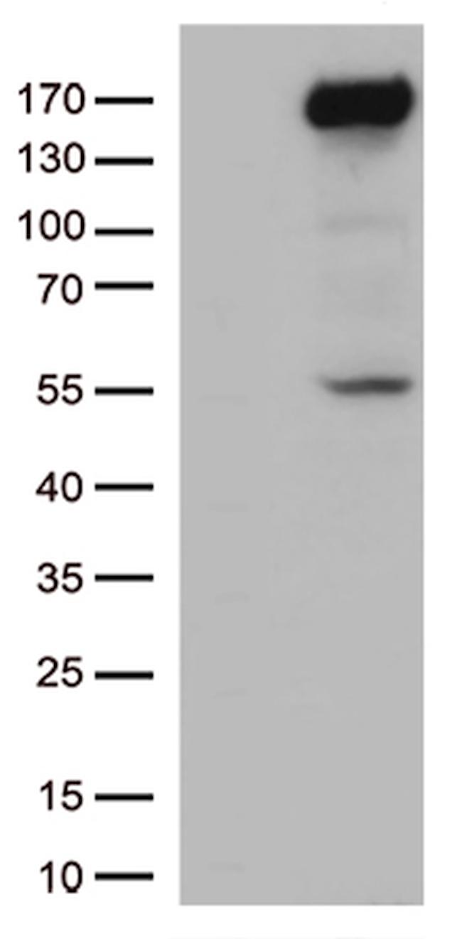 XDH Antibody in Western Blot (WB)