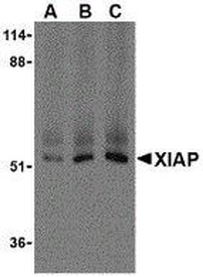 XIAP Antibody in Western Blot (WB)