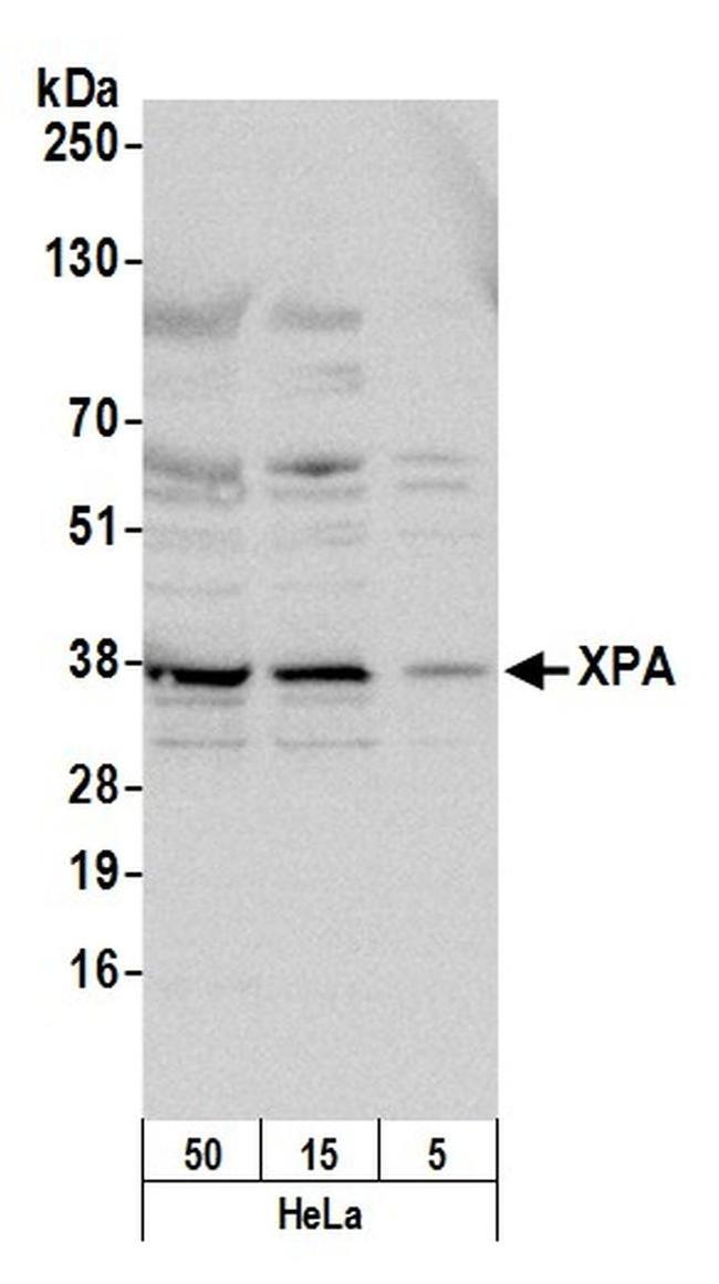 XPA Antibody in Western Blot (WB)