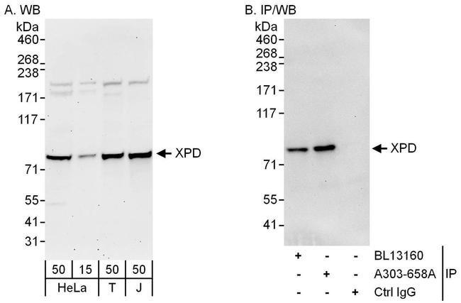 XPD Antibody in Western Blot (WB)