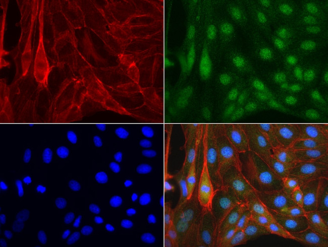 XPF Antibody in Immunocytochemistry (ICC/IF)