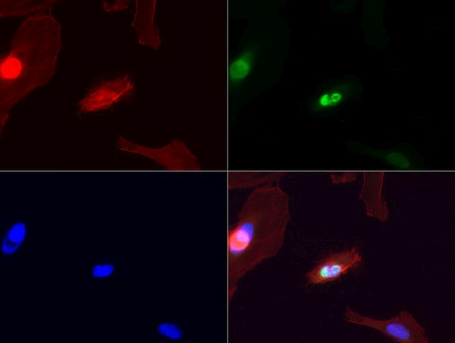 XPF Antibody in Immunocytochemistry (ICC/IF)