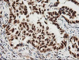 XPF Antibody in Immunohistochemistry (Paraffin) (IHC (P))