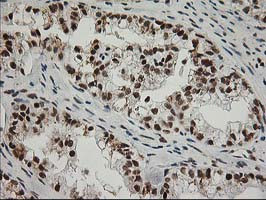 XPF Antibody in Immunohistochemistry (Paraffin) (IHC (P))