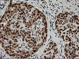 XPF Antibody in Immunohistochemistry (Paraffin) (IHC (P))