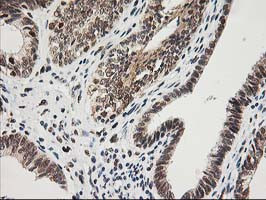 XPF Antibody in Immunohistochemistry (Paraffin) (IHC (P))