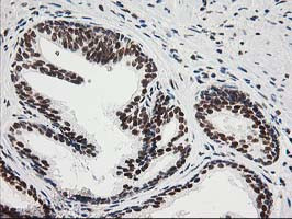 XPF Antibody in Immunohistochemistry (Paraffin) (IHC (P))