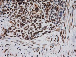 XPF Antibody in Immunohistochemistry (Paraffin) (IHC (P))