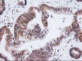 XPF Antibody in Immunohistochemistry (Paraffin) (IHC (P))