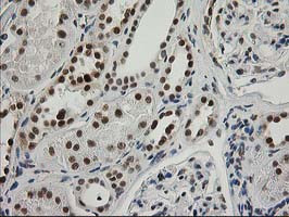 XPF Antibody in Immunohistochemistry (Paraffin) (IHC (P))