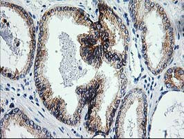 XPF Antibody in Immunohistochemistry (Paraffin) (IHC (P))