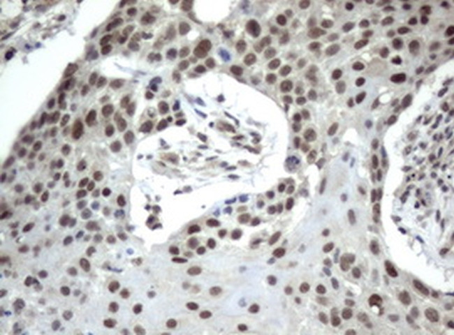 XPF Antibody in Immunohistochemistry (Paraffin) (IHC (P))