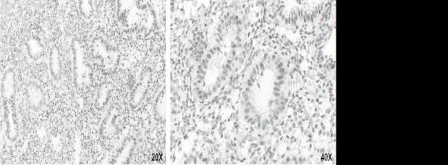 XPF Antibody in Immunohistochemistry (Paraffin) (IHC (P))