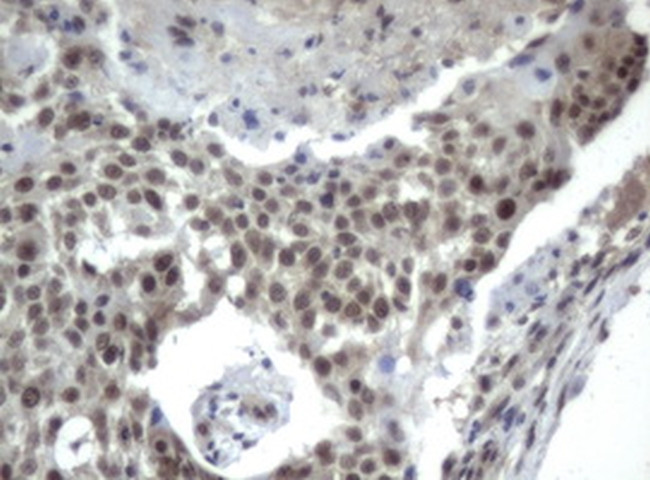 XPF Antibody in Immunohistochemistry (Paraffin) (IHC (P))