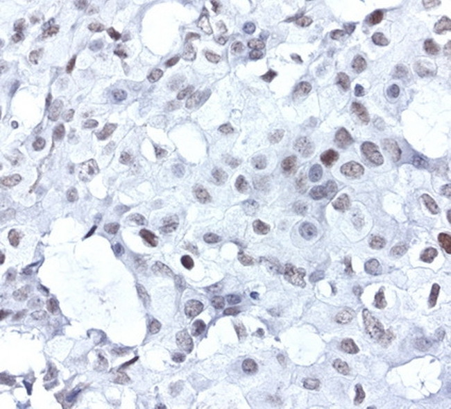 XPF Antibody in Immunohistochemistry (Paraffin) (IHC (P))