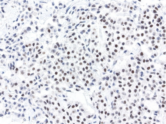 XPF Antibody in Immunohistochemistry (Paraffin) (IHC (P))