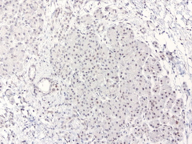 XPF Antibody in Immunohistochemistry (Paraffin) (IHC (P))