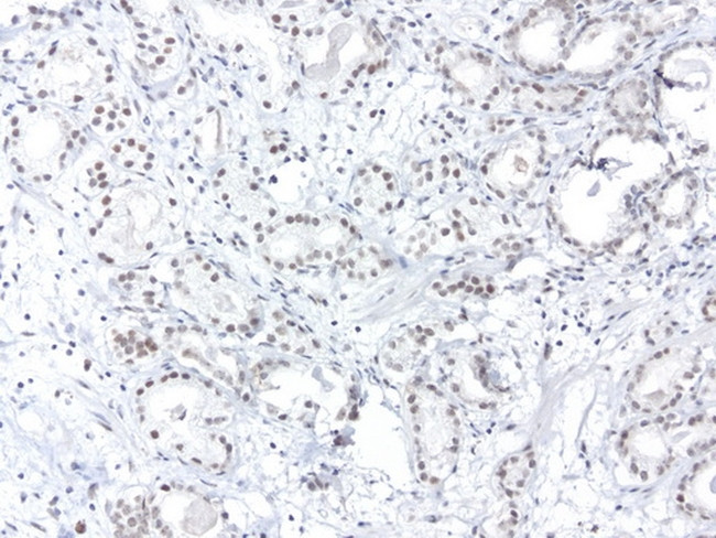 XPF Antibody in Immunohistochemistry (Paraffin) (IHC (P))