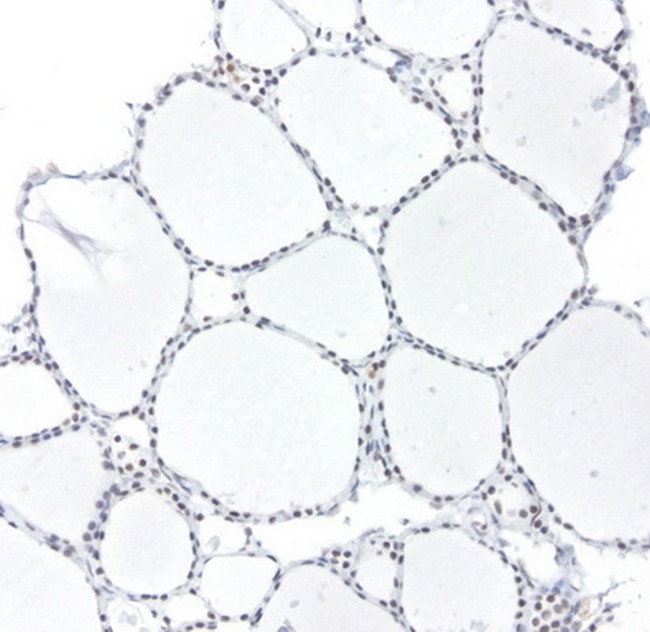 XPF Antibody in Immunohistochemistry (Paraffin) (IHC (P))