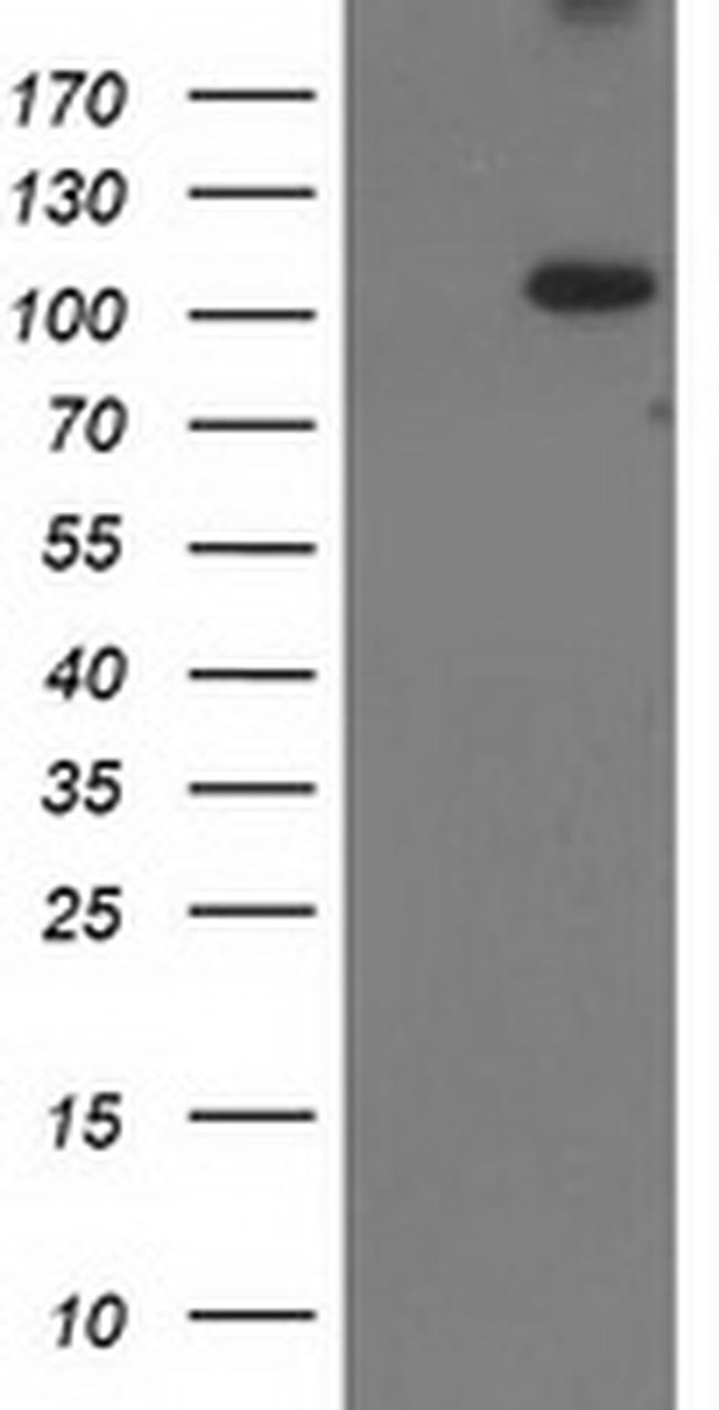 XPF Antibody in Western Blot (WB)