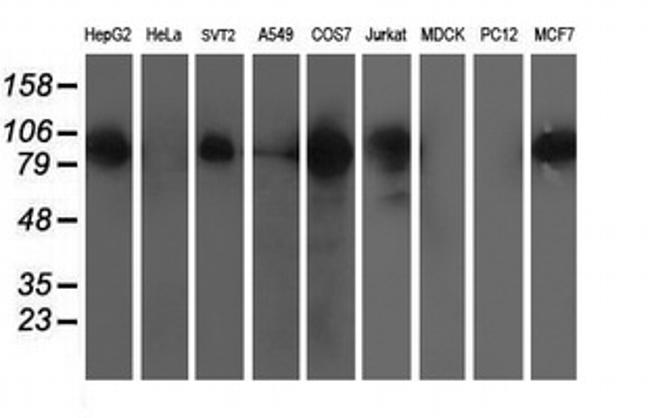 XPF Antibody in Western Blot (WB)