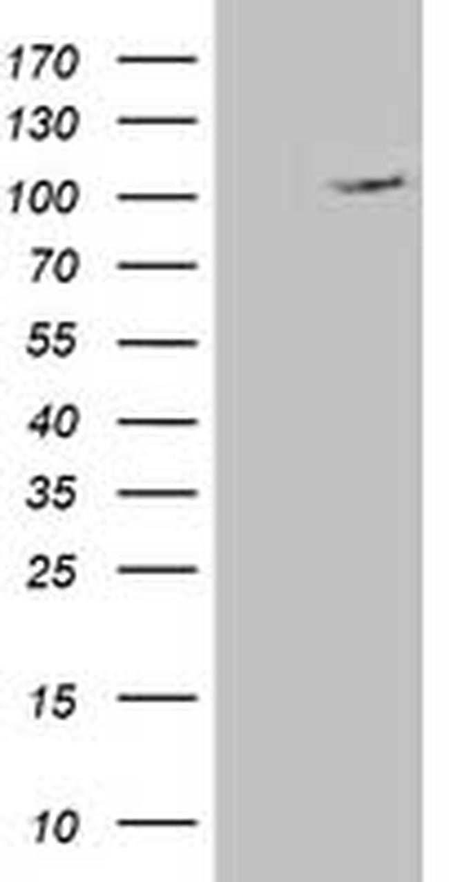 XPF Antibody in Western Blot (WB)