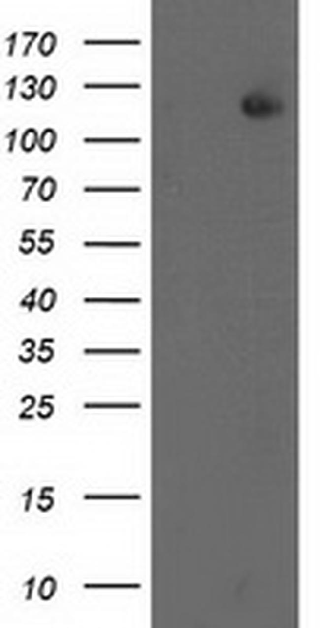 XPF Antibody in Western Blot (WB)