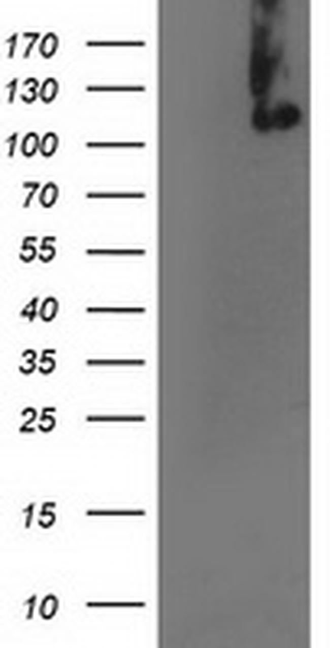 XPF Antibody in Western Blot (WB)