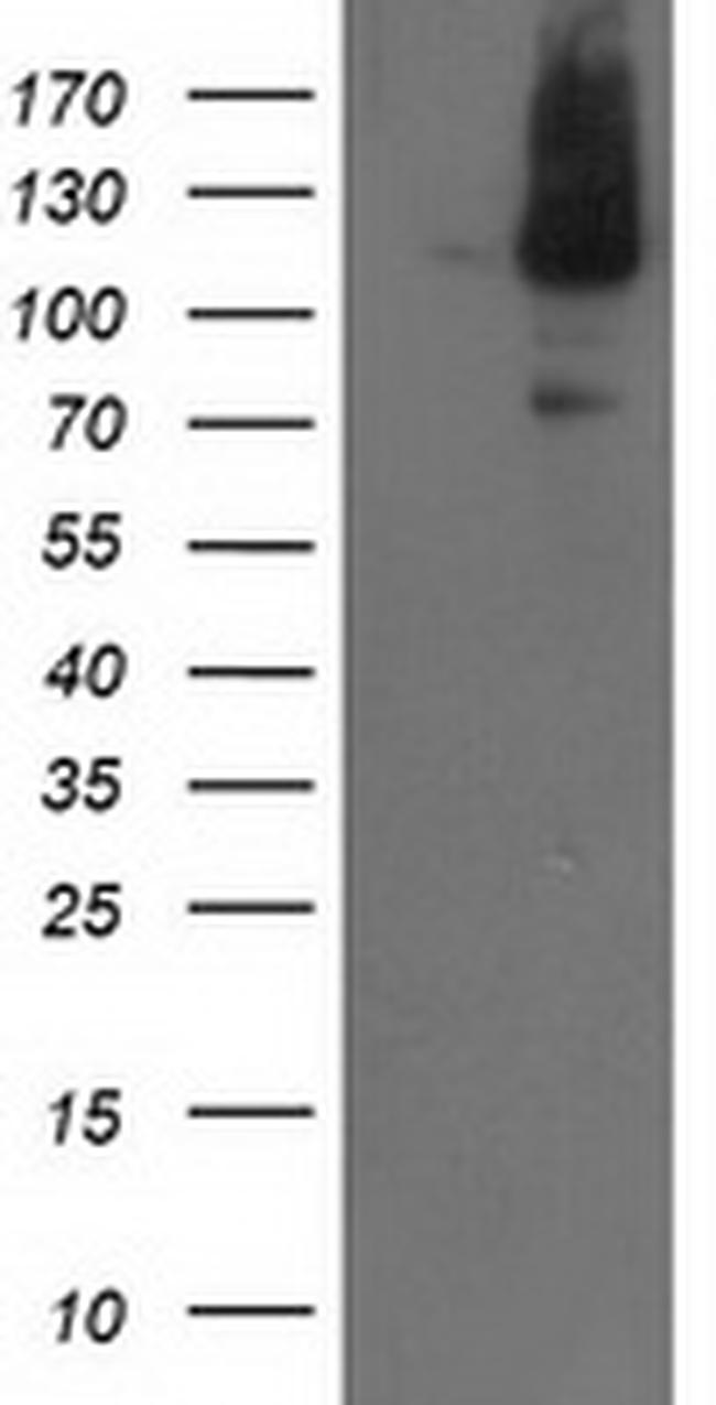 XPF Antibody in Western Blot (WB)