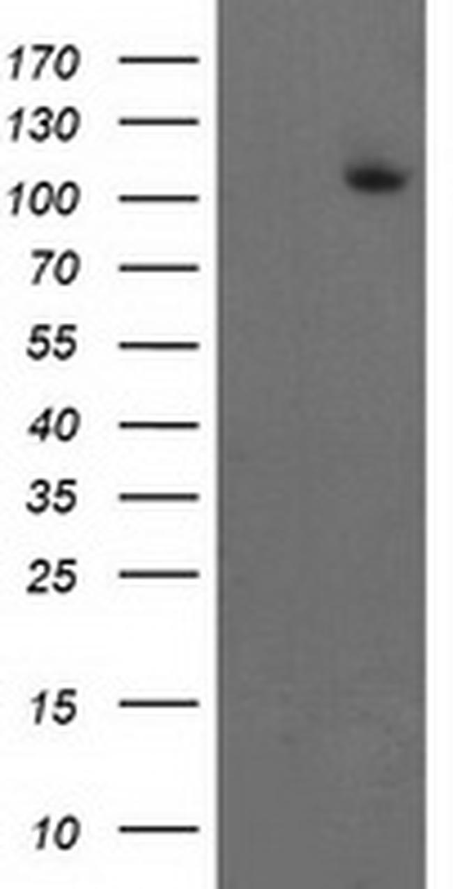 XPF Antibody in Western Blot (WB)