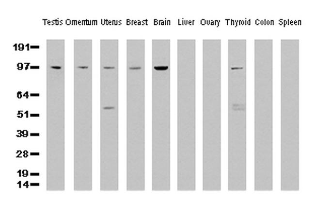 XPF Antibody in Western Blot (WB)