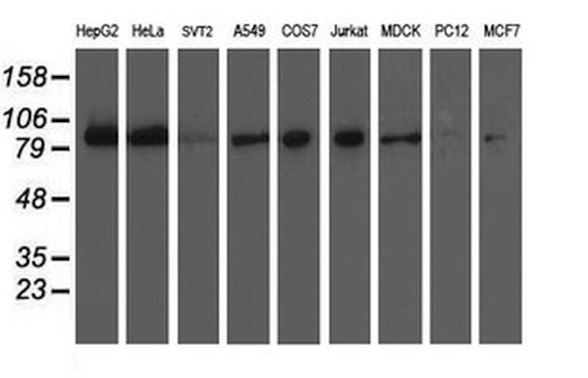 XPF Antibody in Western Blot (WB)