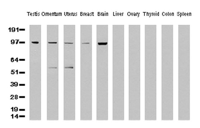 XPF Antibody in Western Blot (WB)