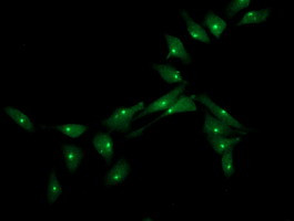 XPNPEP3 Antibody in Immunocytochemistry (ICC/IF)