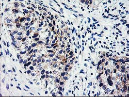 XPNPEP3 Antibody in Immunohistochemistry (Paraffin) (IHC (P))