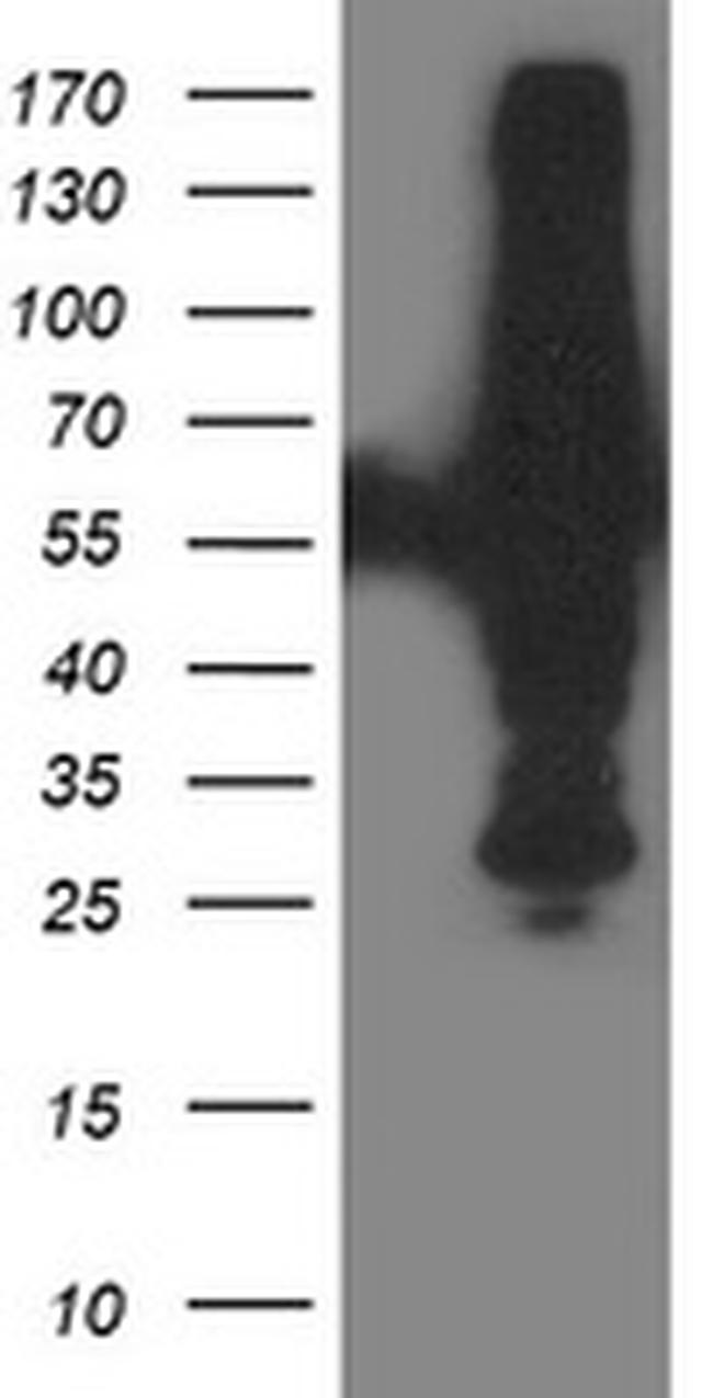 XPNPEP3 Antibody in Western Blot (WB)