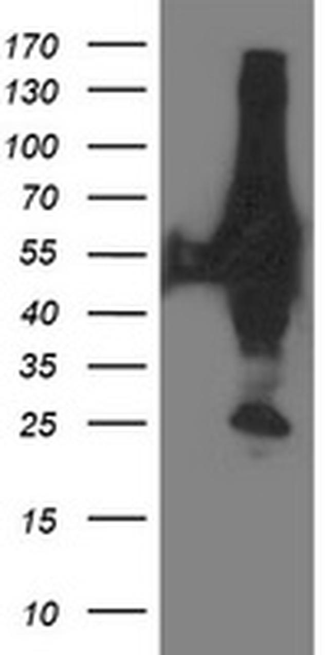 XPNPEP3 Antibody in Western Blot (WB)