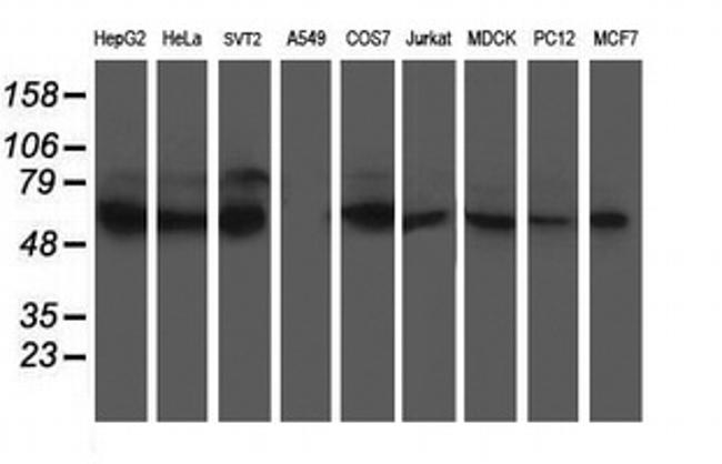 XPNPEP3 Antibody in Western Blot (WB)