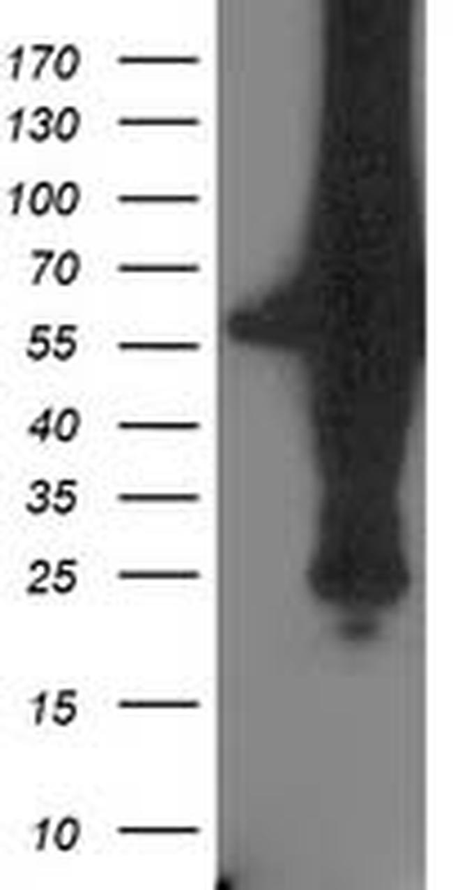 XPNPEP3 Antibody in Western Blot (WB)