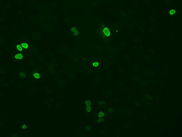 XRCC1 Antibody in Immunocytochemistry (ICC/IF)